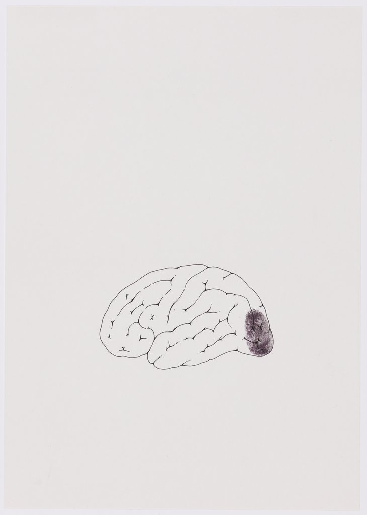 Ohne Titel (Gehirn mit Fingerabdruck), Jochem Hendricks