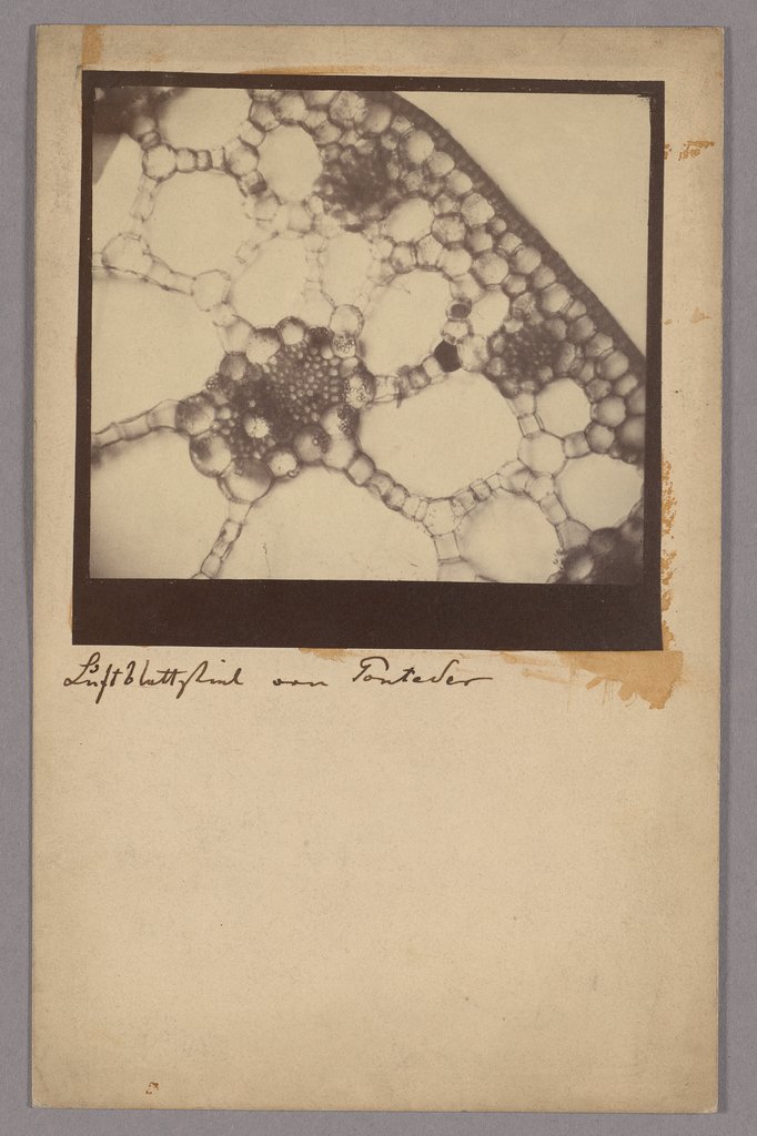 Mikrofotografie, Unbekannt, 19. Jahrhundert